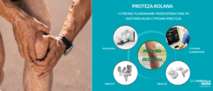 Proteza kolana z indywidualnymi cyfrowymi przymiarami 3D (PSI)
