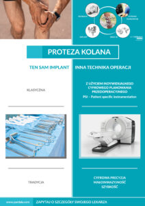 Proteza kolana z indywidualnymi cyfrowymi przymiarami 3D (PSI)