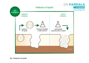 Hodowla-chrząstki