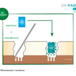 Mikrozłamania + membrana